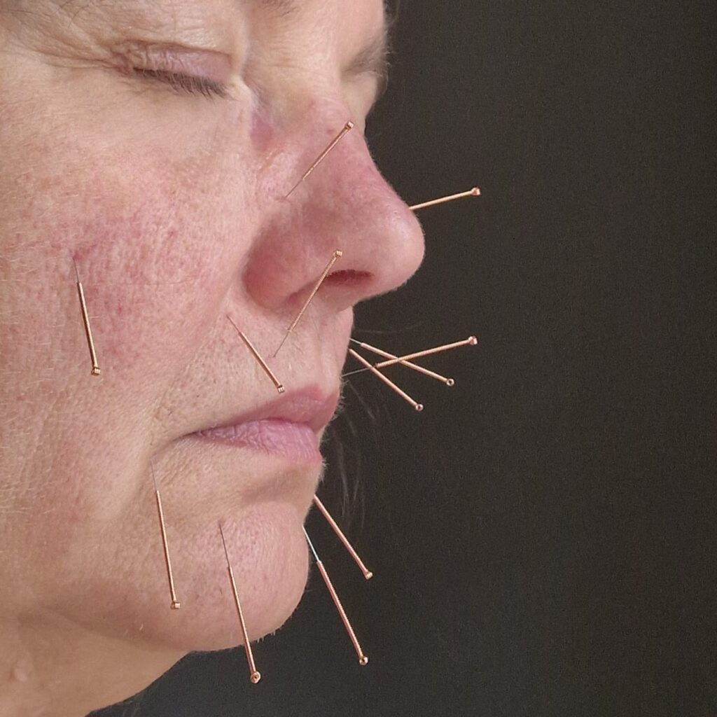 anti aging 3,6
